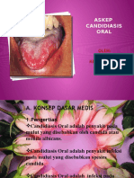 ASKEP Candidiasis Oral New