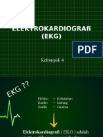 EKG