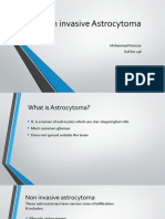 Non Invasive Astrocytoma
