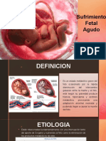 Sufrimiento Fetal