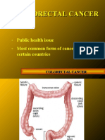 Colorectal cancer - english