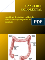 Cancerul Colorectal - Romana