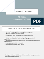 RADIOGRAFI OKLUSAL