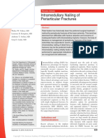 Intramedullary Nailing of Periarticular Fractures.2
