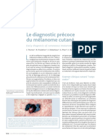 Le Diagnostic Précoce Du Mélanome Cutané: Dossier Thématique