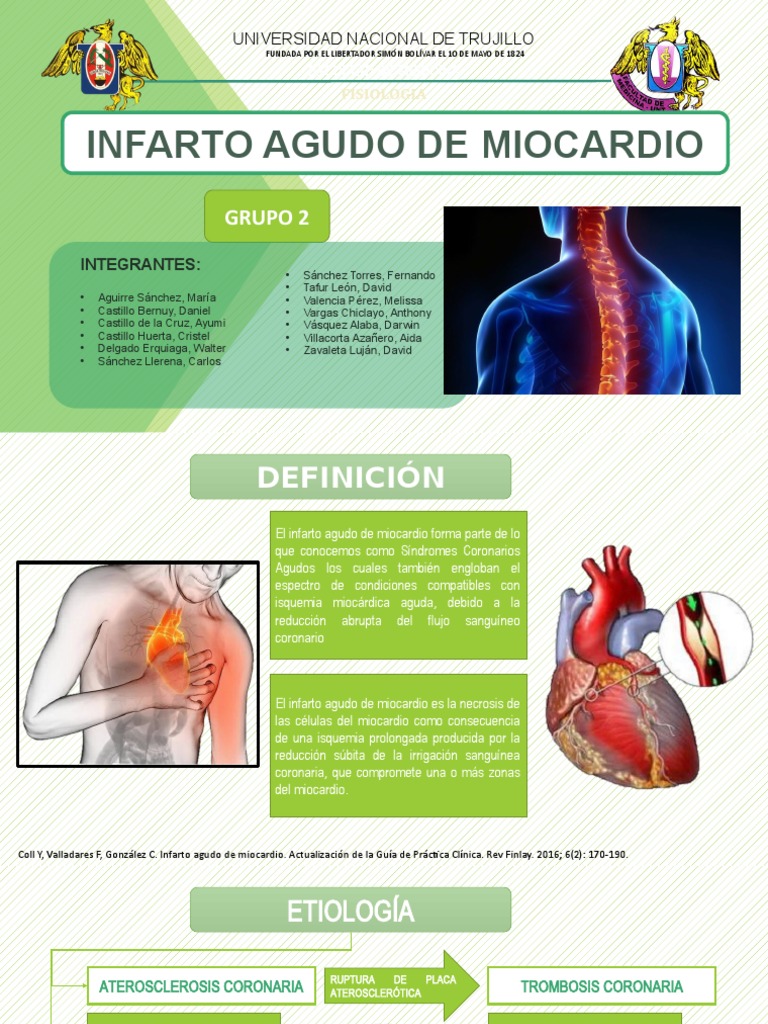 Infarto Agudo de Miocardio | PDF | Electrocardiografia | Infarto de ...