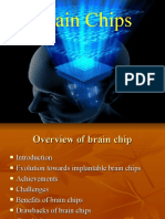 Brain Chip Overview - Implant Benefits & Challenges