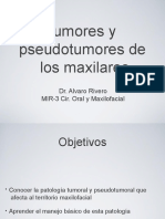 420-2014-02-25-Tumores de maxilares ppt (1)