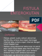 Fistula Enterokutan