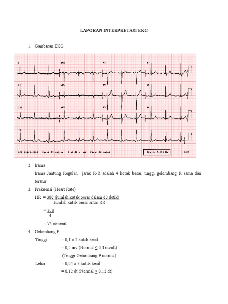 LEMBARAN PENUGASAN Interpretasi Gambaran EKG PDF