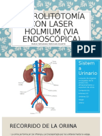 Nefrolitotomía Con Laser Holmium (Via Endoscópica)