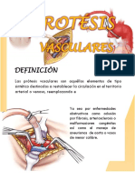 Info de Protesis Vasculares