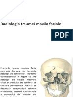 stomatologie trauma Liuda + Andrei.ppt
