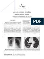 Fibrosis Pulmonar Idiopática PDF