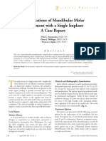 Complications of Mandibular Molar Replacement With A Single Implant-A Case Report