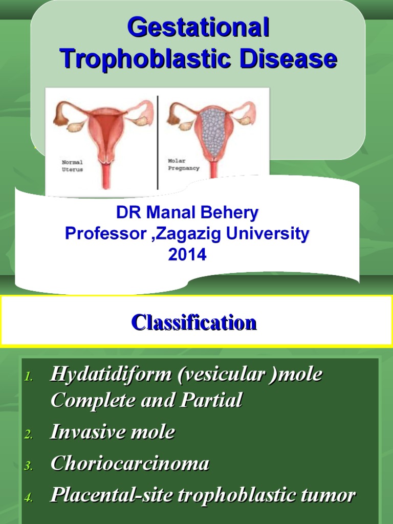 Gestational Trophoblastic Disease | PDF | Human Reproduction | Diseases ...