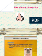 Differential DX of Nasal Obstruction