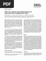 Download spina-bifida- by rebelswanteddot_com SN45753658 doc pdf