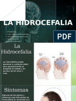 HIDROCEFALIA