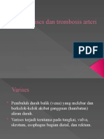 VARISES DAN TROMBOSIS