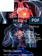 Serangan Jantung