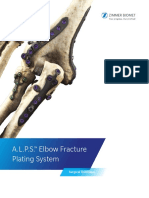 A.L.P.S. Elbow Fracture Plating System: Surgical Technique