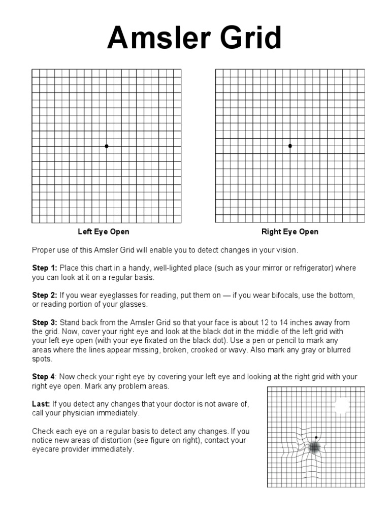 Amsler Grid | PDF