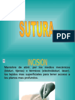 sutura 1.ppt