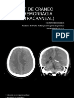 CT de Craneo