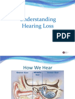 Understanding-Hearing-Loss-Presentation