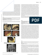 Clonorchiasis Manifesting As Obstructive Jaundice .1266 PDF