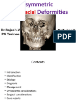 Asymmetric Craniofacial Asymmetries