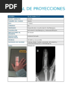RX de Mano Frente | PDF | Mano | Anatomía