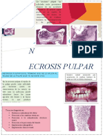 NECROSIS PULPAR Inicio