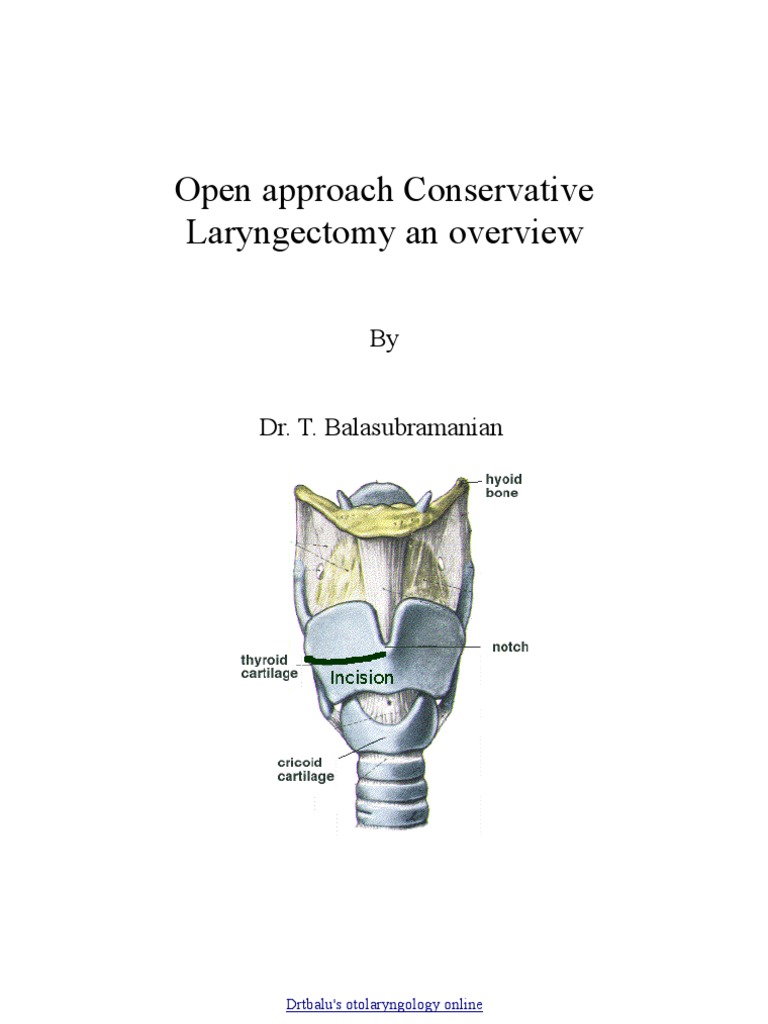 conser_laryngectomy Larynx Surgery