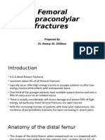 Femoral Supracondylar Fractures: Prepared by Dr. Ramzy Sh. Shikhan