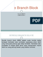 Bundle Branch Block