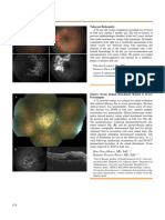 Artículo Oftalmología Retina