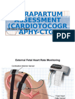Intrapartum Assessment (Cardiotocography-CTG