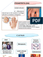 Dolor articular crónico: causas, síntomas y tratamiento de la osteoartritis