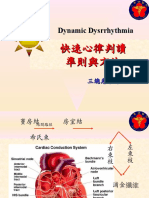 Dynamic Dysrrhythmia