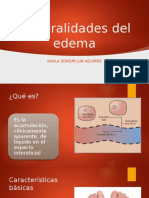 Edema