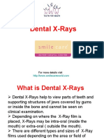 Dental X-Rays 