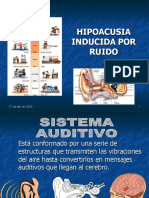 Hipoacusia Inducida Por Ruido