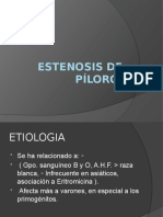 ESTENOSIS de Píloro