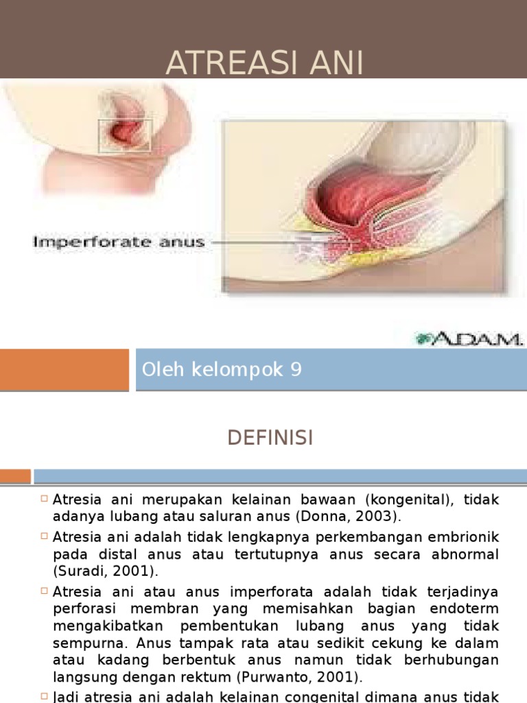 Paypoqdagi jinsiy aloqa Crotney Keyn