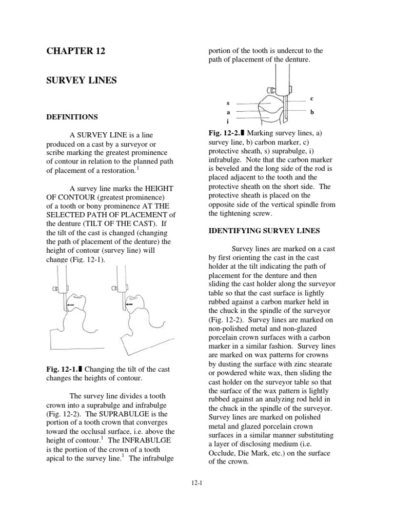 Survey Lines in Prosthodontics | PDF | Tooth | Dental Anatomy