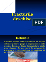 Fractura Deschisă