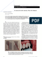 Emergence Profile in Natural Tooth Contour