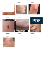 enfermedades de la piel.docx